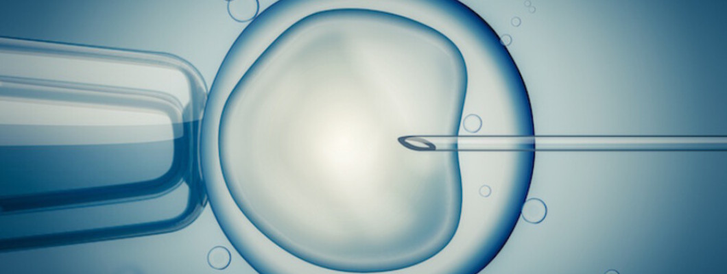 IVF-In Vitro Fertilization IVF-In Vitro Fertilization