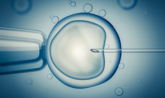 IVF-In Vitro Fertilization